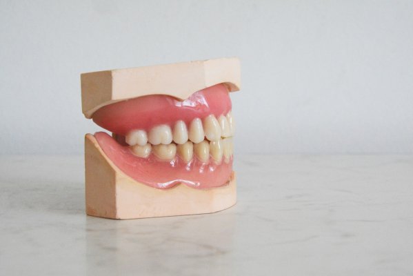 a set of denture on a clean display setup